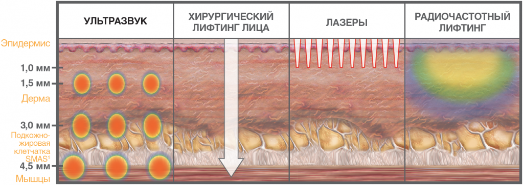 смас лифтинг