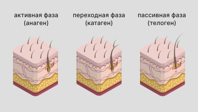 Лечение алопеции